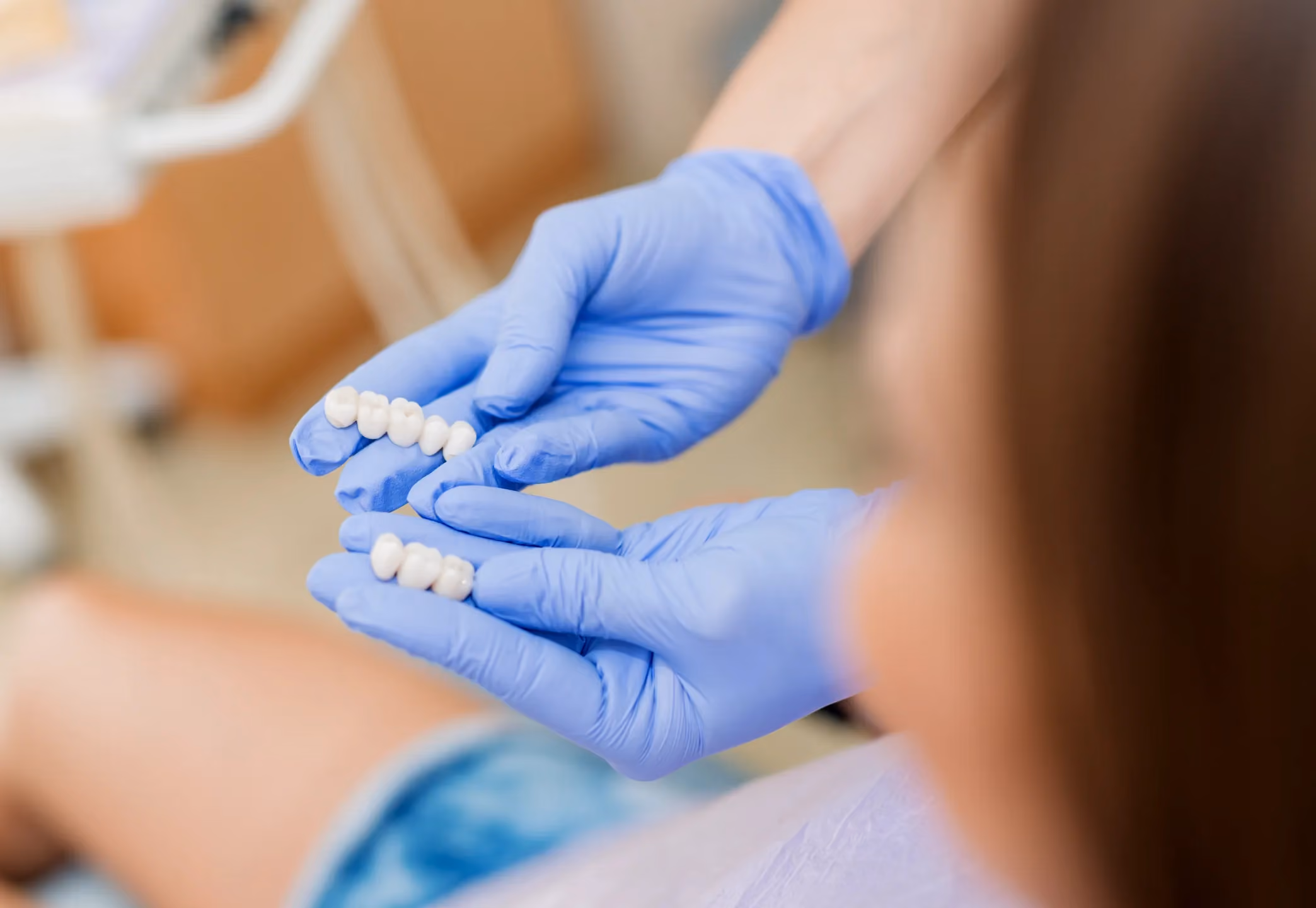 Porcelain Crowns