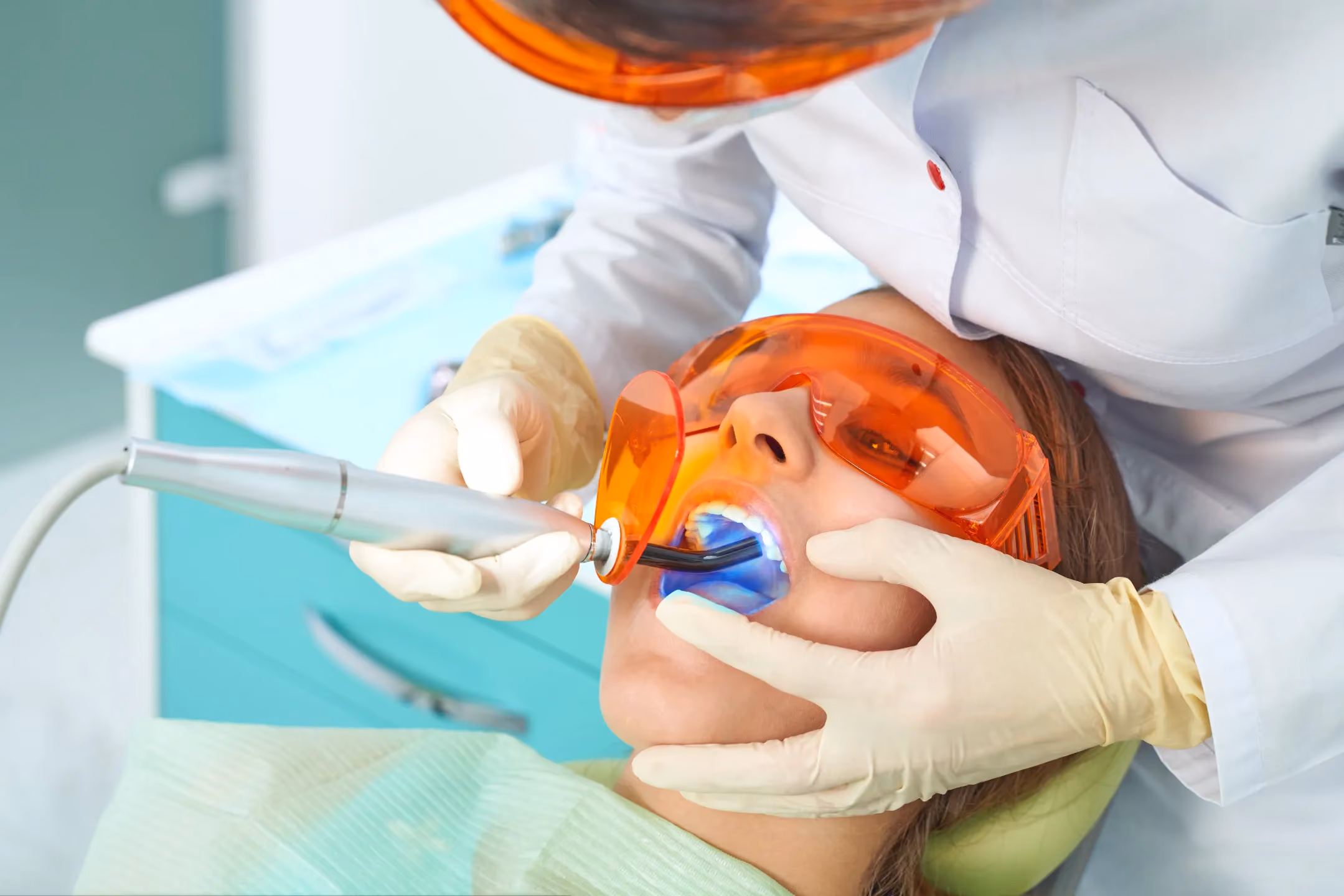 Tooth-Colored Fillings